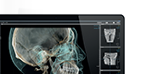 OnDemand3D Dental 1.0.11.1007 (2024) 3D Imaging Software With Crack