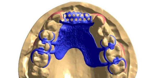 C4W DIGILEA Suite 2020.12.v01 (CAD Solutions for Digital Dental Design) Download